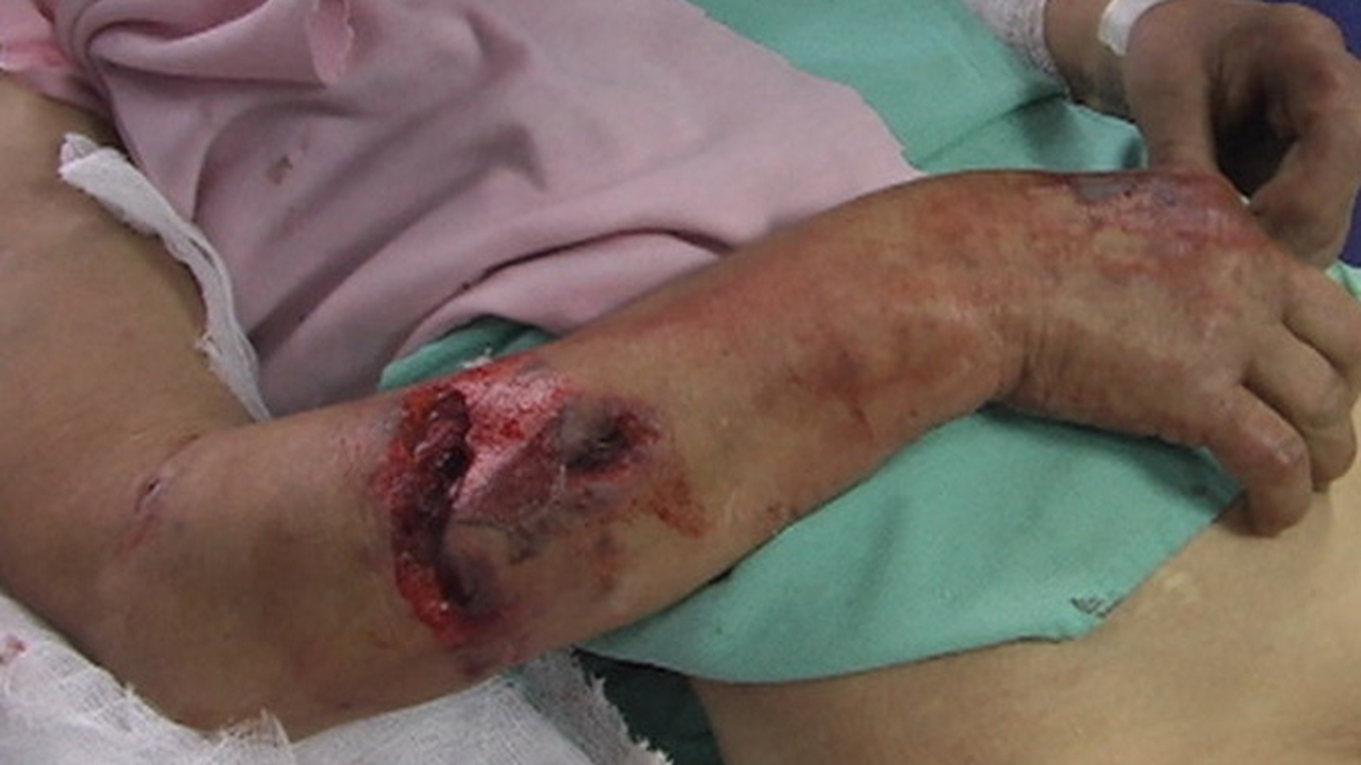 IMAGINI SOCANTE! Mutilata de 10 caini maidanezi!
