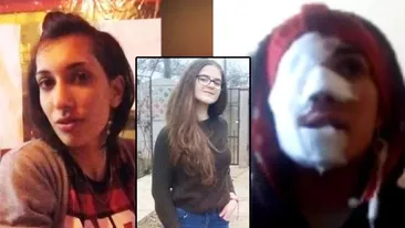 O românca din Italia, care ar fi stat de vorba cu Alexandra Măceșanu, a fost batută cu bestialitate după ce a oferit informaţii în anchetă: „Așa arăt pentru că am vrut să salvez o fată”