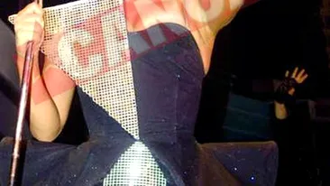 I-a spart dintii unui balerin