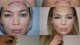 Adina Alberts: "Gina Pistol nu e obsedata de interventiile estetice" Uite cum arata iepurasul Playboy inainte si dupa operatii!