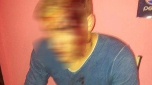 Imagini SOCANTE! Un fotbalist englez a fost lovit cu TOPORUL in cap. Afla cine este de vina