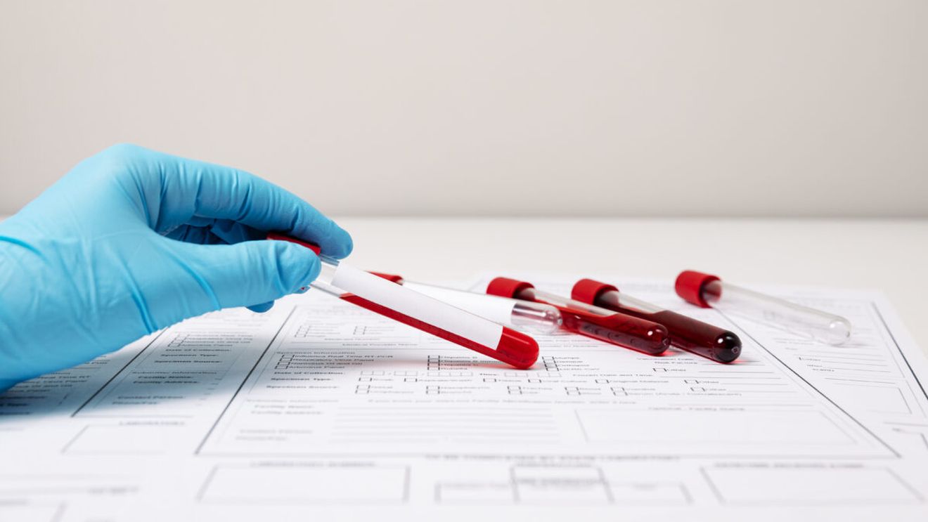 El este pacientul „zero”, care a adus lepra în Europa! De la el a pornit totul, iar autoritățile ar fi mușamalizat cazul