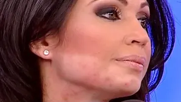 Adevarata fata a Nicoletei Luciu! A fost plina de bube, iar tenul ei arata acum… Vezi cele mai noi imagini, la lumina zilei