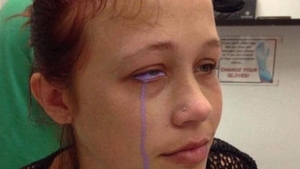 Dimineața s-a trezit cu o durere cumplită la un ochi. Îi curgeau lacrimi mov și a fugit la spital. Motivul este șocant