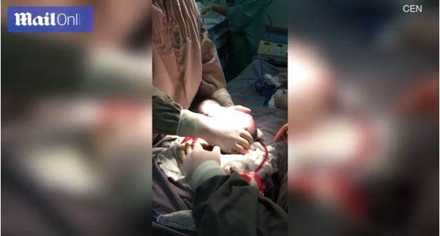 Imagini emoționante în sala de operații: un băiețel s-a născut în timp ce era încă în sacul amniotic. Cazul este foarte rar: 1 la 80.000 de nașteri | FOTO & VIDEO