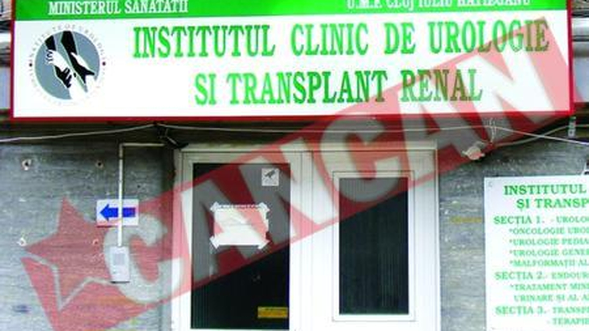 Premiera la Institutul de Transplant Renal
