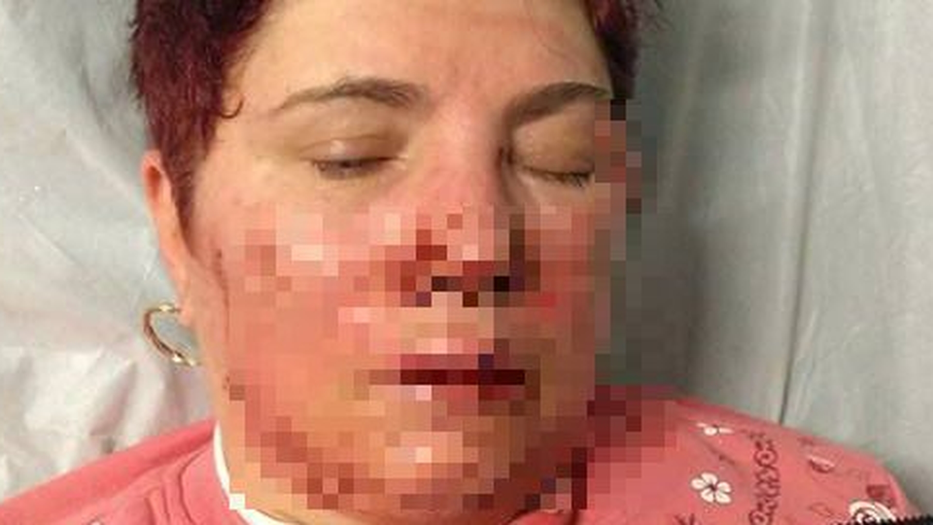 Mesaj disperat al fiului uneia dintre cele 5 femei bătute crunt şi jefuite la Botoşani: ”Ofer recompensă celui care...”