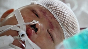VIDEO Fetita de doi ani calcata de doua masini traieste! Micuta este in coma
