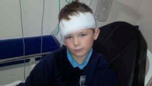 Era sa ramana fara ureche dupa ce a fost muscat de un caine! Momentele ingrozitoare prin care a trecut un baietel