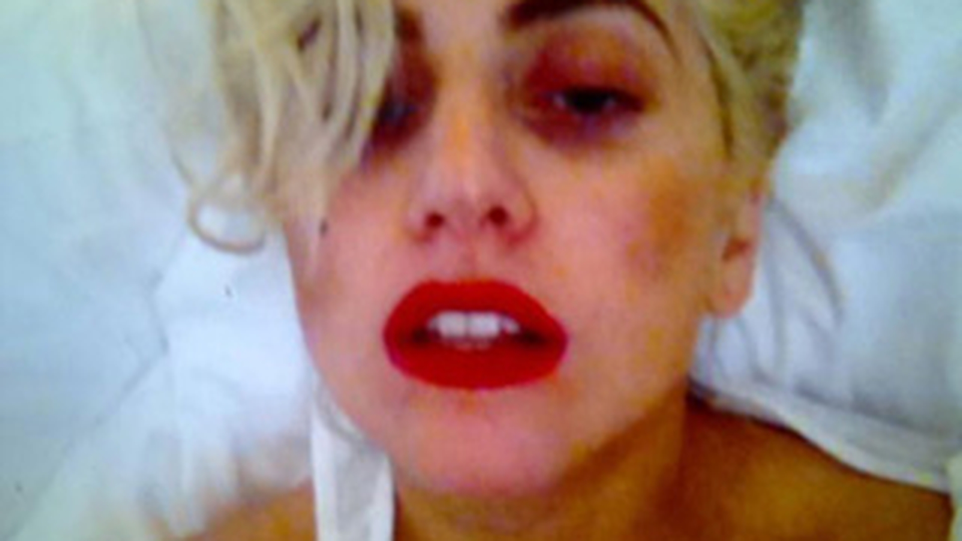 Vezi cum arata Lady GaGa dupa ce a fost lovita pe scena!