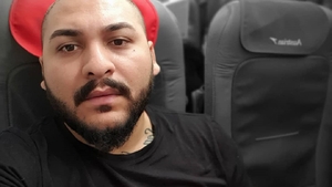 Cum arată acum Dani Mocanu, la nici o lună după ce şi-a făcut implant de păr. În primele zile era desfigurat
