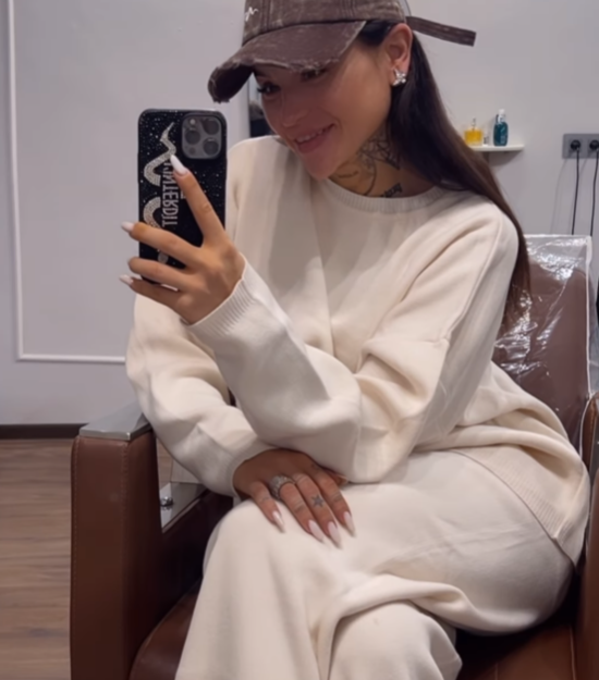 Diandra și-a topit acidul din buze/ Sursa foto: Instagram