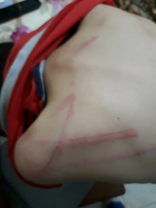 Copilul a fost bătut cu cruzime de tatăl său