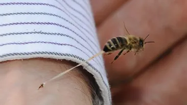 Si tu poti avea problema asta, fara sa stii! Ce a patit o femeie dupa ce a fost intepata de o viespe