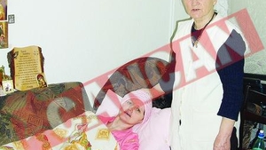 O femeie traieste cu jumatate de craniu