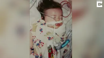 Fetita cu „tentacule”! Medicii i-au spus femeii sa faca avort, dar ea nu a vrut sa auda de asta! Cum arata micuta pe care a adus-o pe lume?