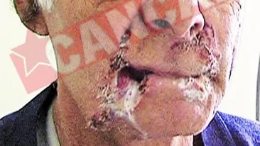 A ramas fara buze, dupa ce a sarutat o iapa