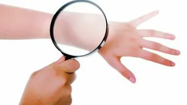 O Boala misterioasa produce rani ale pielii