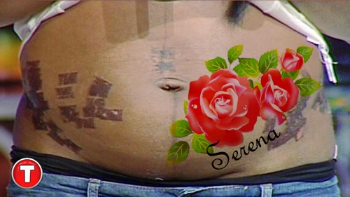 Cum a ales o vedeta de la noi sa isi mascheze urmele lasate pe abdomen dupa ce a fost mutilata la un salon de infrumusetare!