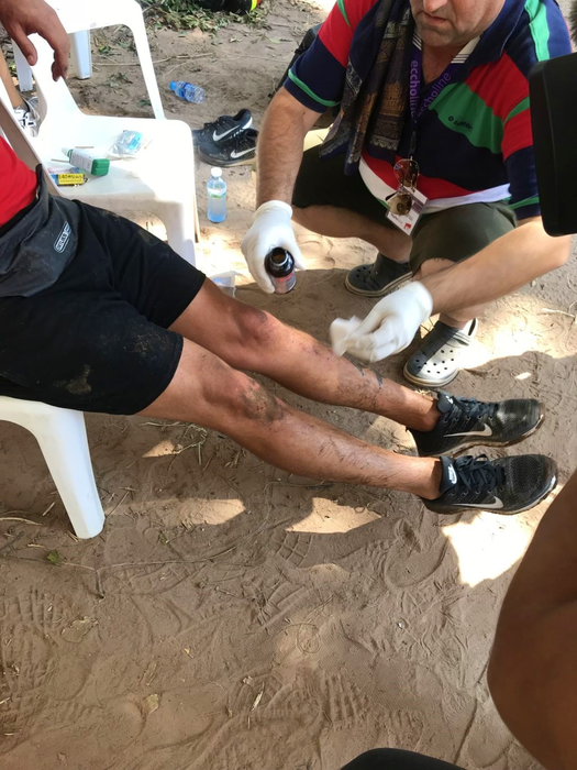 Accidentări în lanț la Asia Express! Liviu Vârciu și Vica Blochina, plini de sânge. Au avut nevoie de îngrijiri medicale