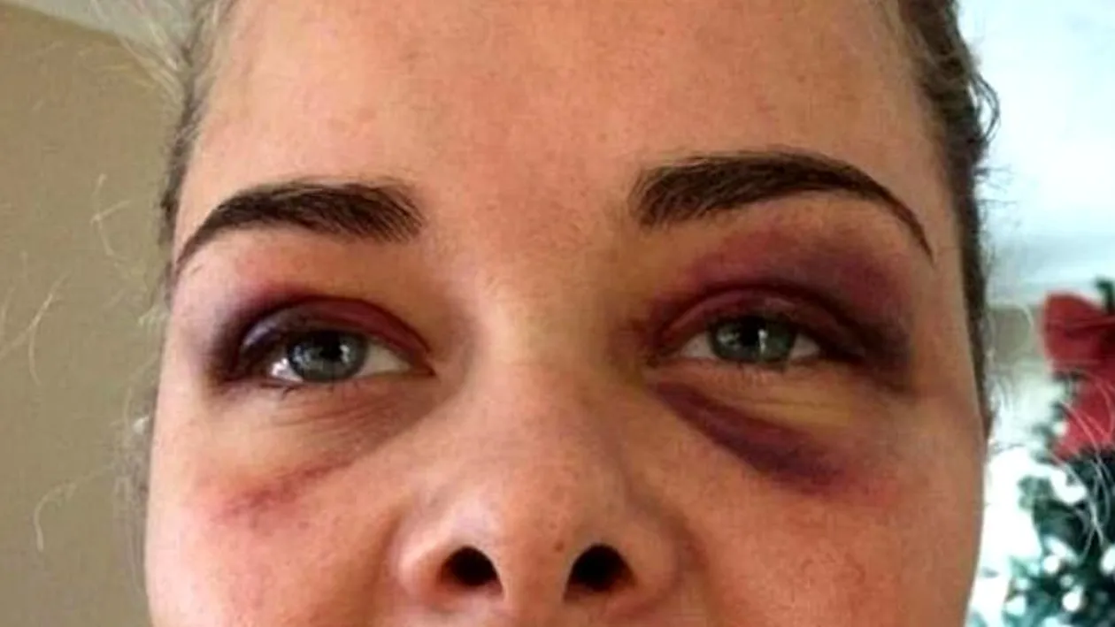 O femeie a rămas fără dinți în gură după ce iubitul ei a aflat că el nu mai apare în poza ei de profil de pe Facebook!