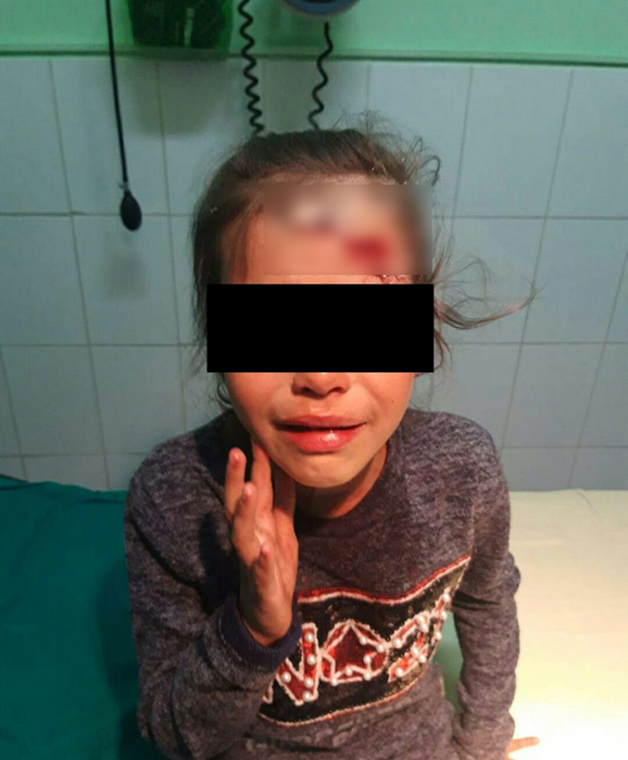 Fetița a ajuns de urgență pe mâna medicilor