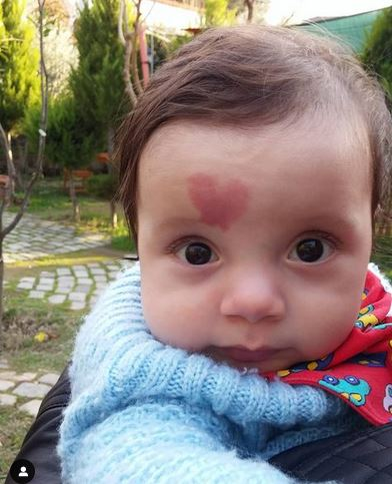 Cazul care a uimit medicii. O femeie a născut un bebeluș cu o inimă în frunte. Cum arată băiețelul acum, la 6 ani