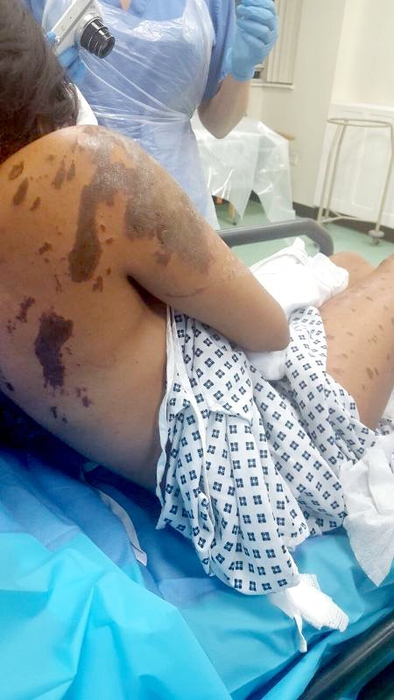 VIDEO / Voia să ajungă manechin celebru, dar soarta a lovit-o crunt! I-a aruncat cu acid sulfuric în faţă şi a distrus-o! Ce a făcut apoi agresorul