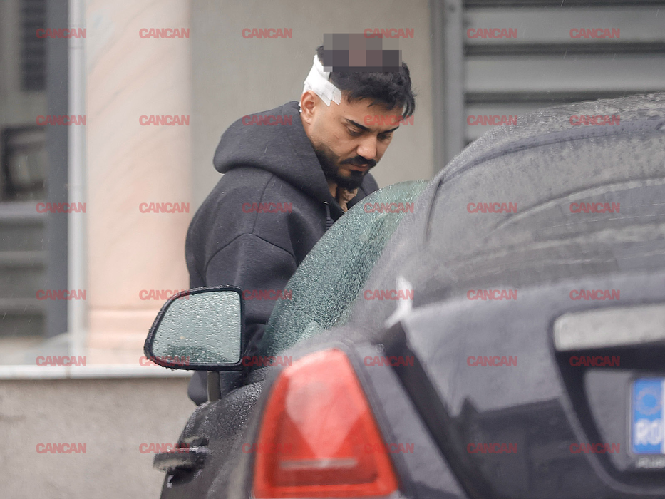 Avem primele imagini cu Jador, după ce și-a pus implant de păr