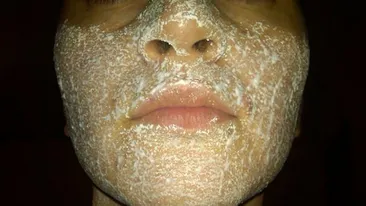 A tocat aspirina si s-a dat cu ea pe fata! Cum arata pielea femeii de dimineata VIDEO