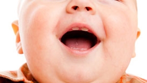 ATENTIE PARINTI!Copiii obezi la trei ani  vor avea probleme grave de sanatate