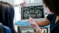 (P) Ce trebuie să știi despre radiologia dentară: tipuri, tarife și utilitatea ei în stomatologie