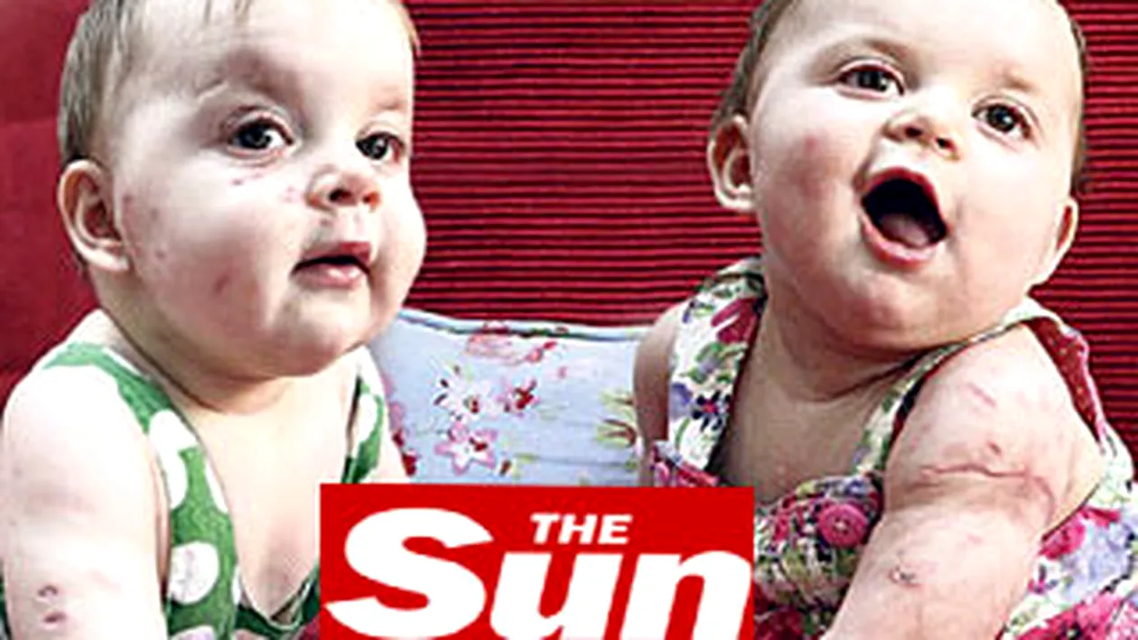 VEZI AICI Cum arata gemenele de noua luni muscate de vulpe