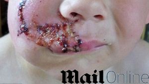 Un baietel de trei ani a fost desfigurat de un Labrador! Are 40 de copci si va ramane cu o cicatrice imensa