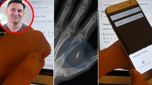 Motivul pentru care George Buhnici și-a implantat un microcip în mâna stângă: "Un doctor mi l-a injectat cu o seringă"