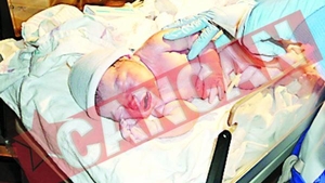 S-a nascut in coma alcoolica